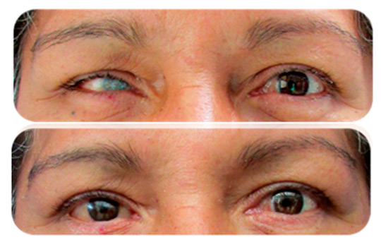 ocul